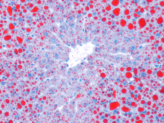 Oil red O histology image