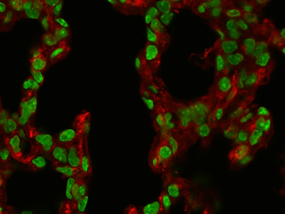 confocal microscope image of lung