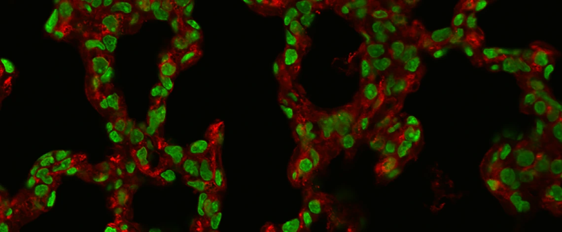 confocal microscope image of lung