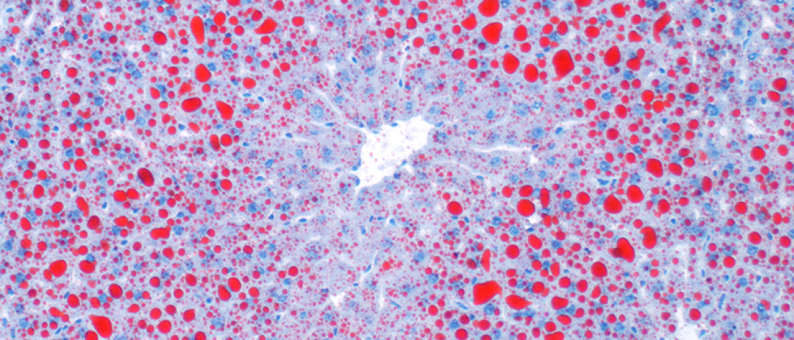 Oil red O histology image